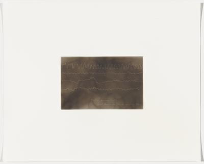 Mother giving birth, fetal heartbeats (twins) in utero, 1898, Plate 8 from The First Time, The Heart (A Portrait of Life 1854-1913)