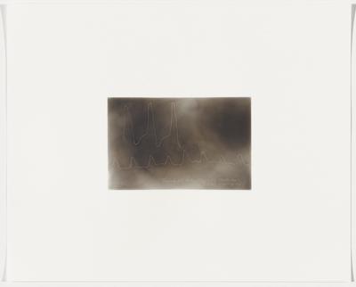 Female, 24, exhaustion with excitement, pulse leaping, 1867, Plate 10 from The First Time, The Heart (A Portrait of Life 1854-1913)