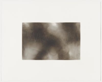 Young girl, 15, heart palpitations, 1886, Plate 14 from The First Time, The Heart (A Portrait of Life 1854-1913)